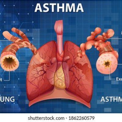 human-anatomy-asthma-diagram-illustration-260nw-1862260579