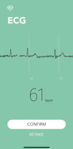 N9+ ECG result screen