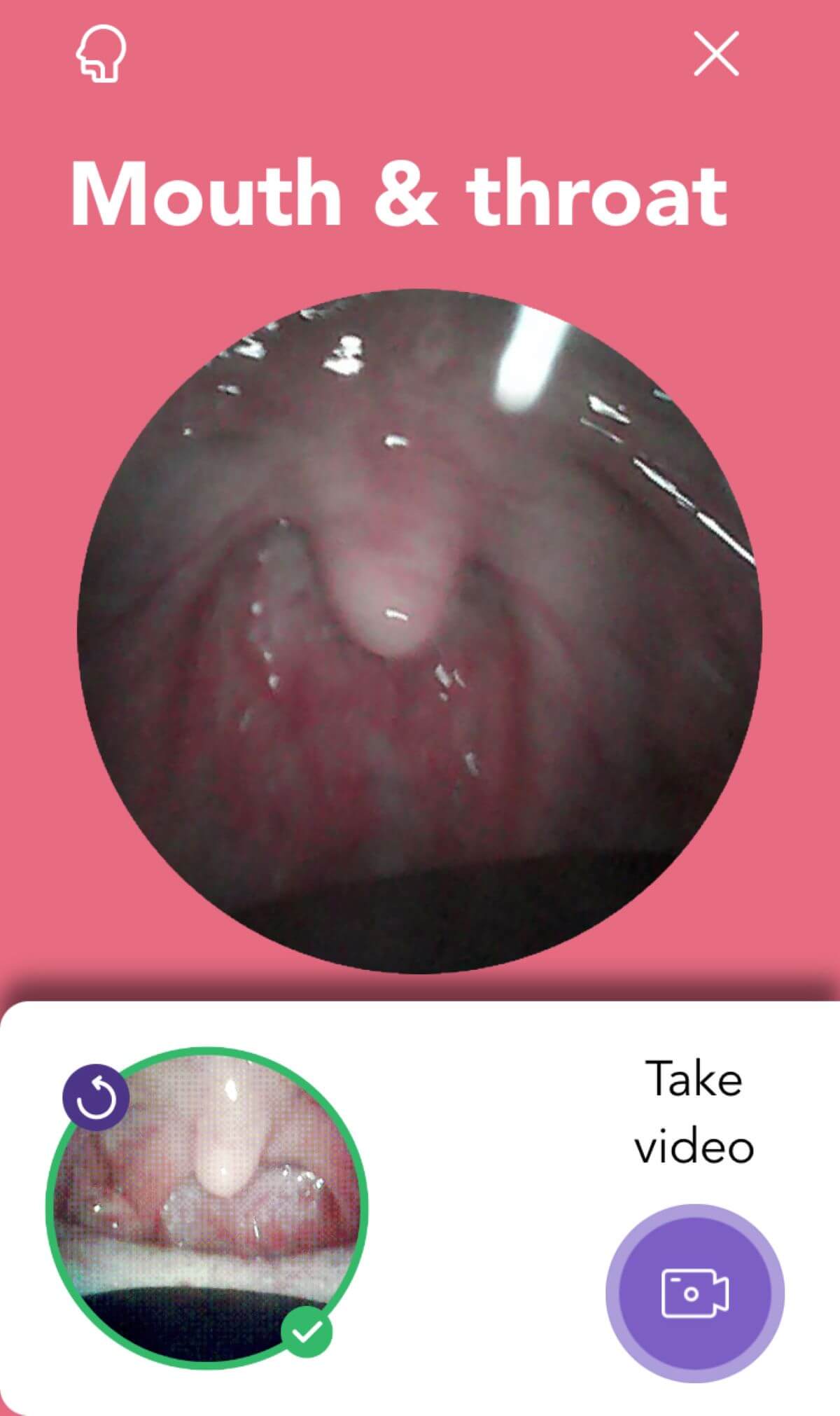Mouth & Throat N9+ app guidance screen