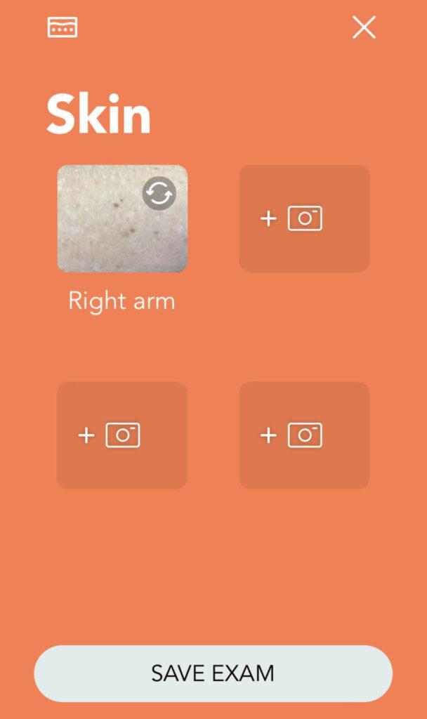 Skin N9+ app guidance screen
