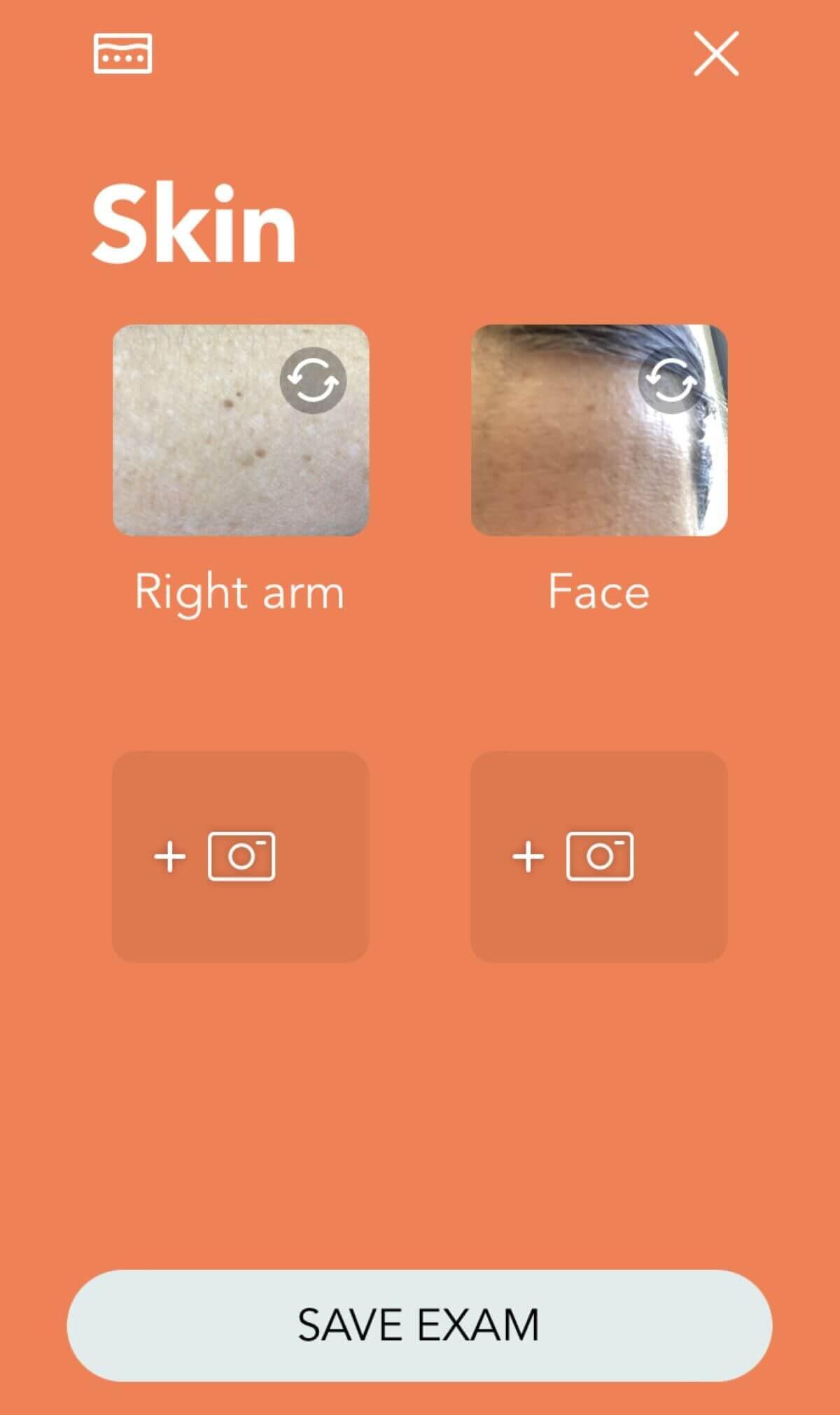 Skin N9+ app guidance screen